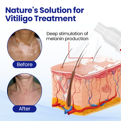 Nexisify™ VitiClear Herbal Spray
