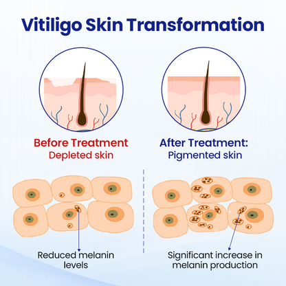 Nexisify™ VitiClear Herbal Spray