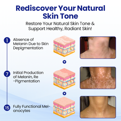 Nexisify™ VitiClear Herbal Spray