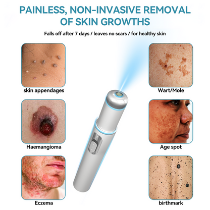 Nexisify™ Medical-Grade Laser Pen