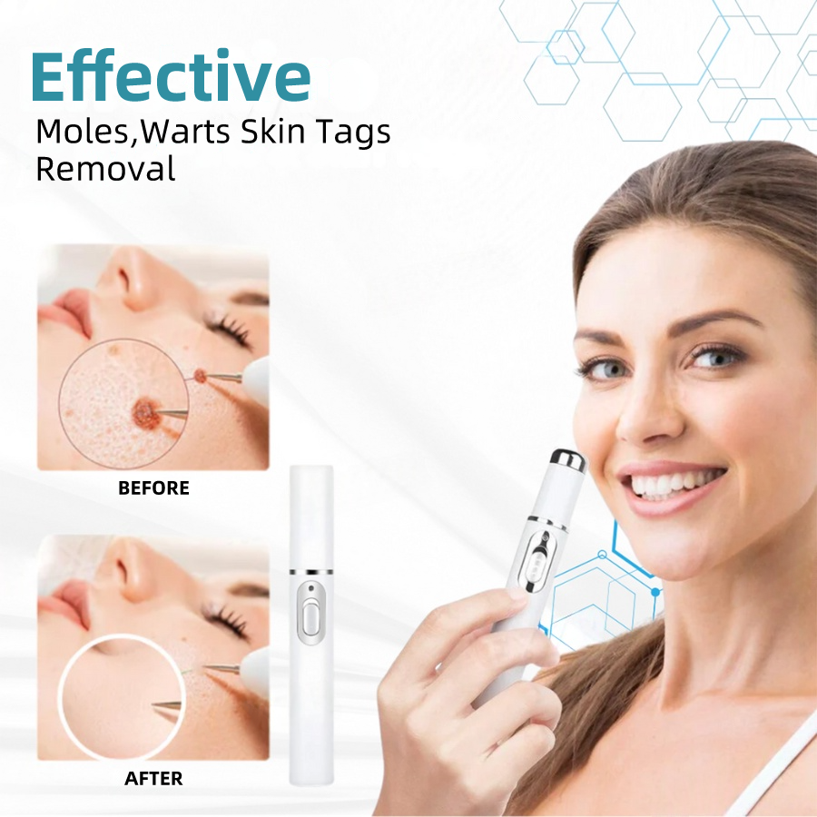 Nexisify™ Medical-Grade Laser Pen