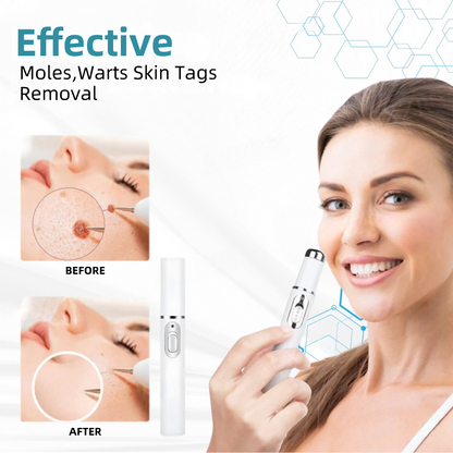 Nexisify™ Medical-Grade Laser Pen