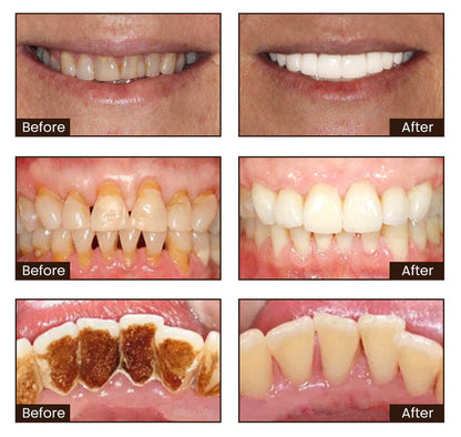 Niacinamide Whitening Toothpaste