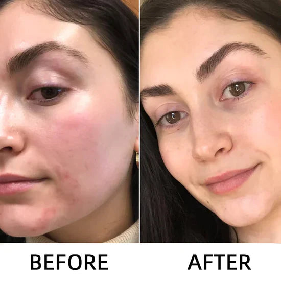 Misspone™ Rice Renewal Ampoule Serum